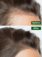 Hair Repair Serum by Shya Haircare